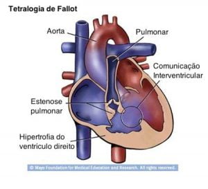 centro-de-cardiopatias-congenitas