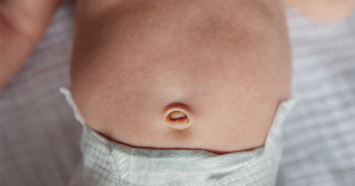 A saúde digestiva afeta o cuidado de crianças complexas e deve ser abordada de forma multidisciplinar